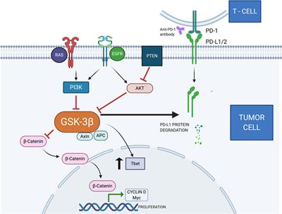 Glycogen Synthase Kinase-3 Beta Expression Correlates With Worse Overall Survival in Non-Small Cell Lung Cancer—A Clinicopathological Series